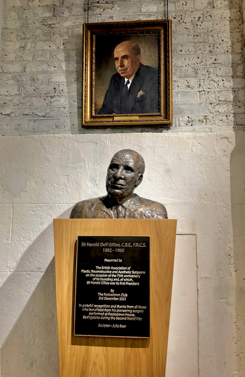 Display of Harold Gillies’ Bust in The RCS