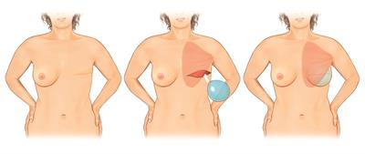 Figure 2 Figure 2