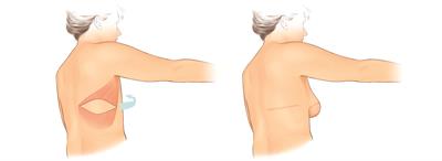 Figure 3 Figure 3