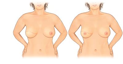 Figure 4 Figure 4