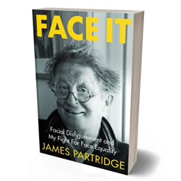 FACE IT: Facial Disfigurement and my Fight for Face Equality