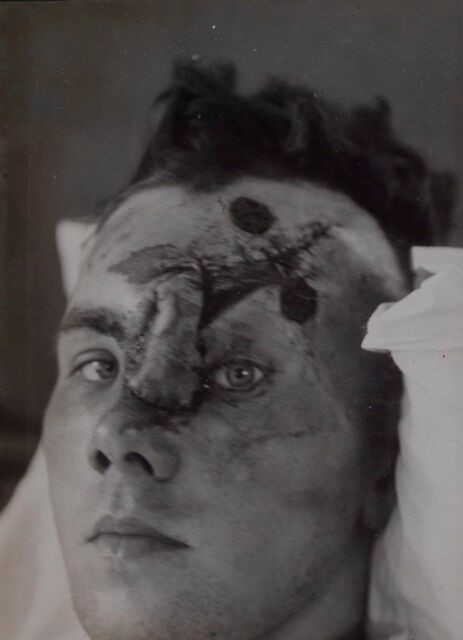Plastic Surgery: The Surgical Specialty of World War One